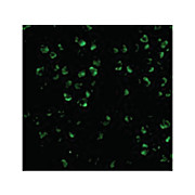 ASK1 Antibody 100µg