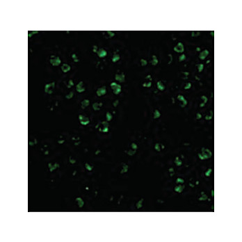 ASK1 Antibody 100µg