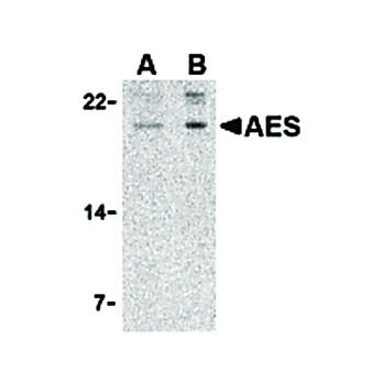 AES nterm Antibody 100µg