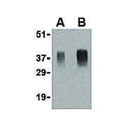 APH1 internal Antibody 100µg