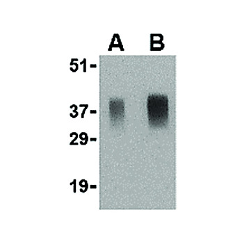 APH1 internal Antibody 100µg