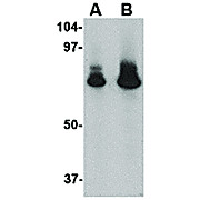 ATG16 nterm Antibody 100µg