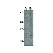 Anti-Bst2 (RABBIT) Antibody, 100µg, Liquid (sterile filtered)