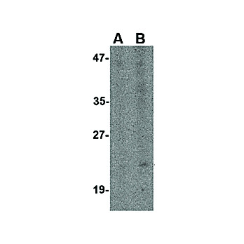 Anti-Bst2 (RABBIT) Antibody, 100µg, Liquid (sterile filtered)