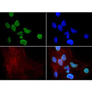 Anti-Histone H3 [Monomethyl Lys9] (RABBIT) Antibody, 50µg, Liquid (sterile filtered)