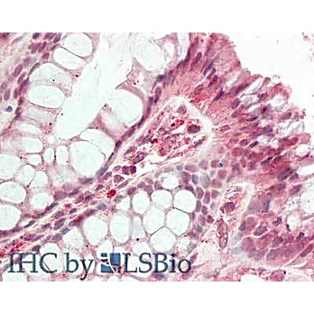 HDAC5 (3 internal) Antibody 100µg