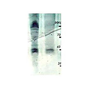 Anti-PhosphoThreonine (pT) [RABBIT] Antibody Peroxidase Conjugated, 100µg, Liquid (sterile filtered)