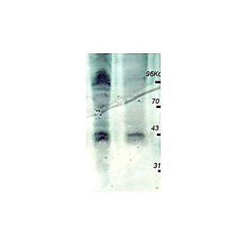 Anti-PhosphoThreonine (pT) [RABBIT] Antibody Peroxidase Conjugated, 100µg, Liquid (sterile filtered)