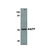Anti-AFP (RABBIT) Antibody, 100µg, Liquid (sterile filtered)