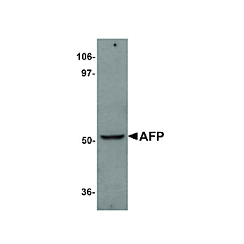 Anti-AFP (RABBIT) Antibody, 100µg, Liquid (sterile filtered)