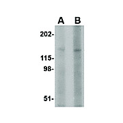 BAP3 Antibody 100µg