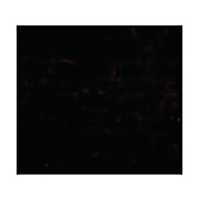 BRAL1 Antibody 100µg