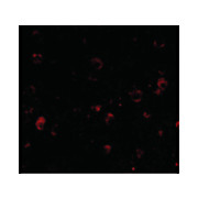 BRSK1 Antibody 100µg