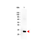 Anti-HUMAN ? (lambda chain) (GOAT) Antibody Peroxidase Conjugated, 1mg, Lyophilized