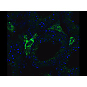 ACE2 - nterm Antibody 100µg