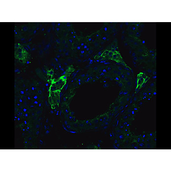 ACE2 - nterm Antibody 100µg