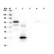 Anti-CHICKEN IgG F(c) (RABBIT) Antibody Peroxidase Conjugated, 1.5mg, Lyophilized