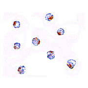 Rb AAK1 Antibody- nterm 100µg