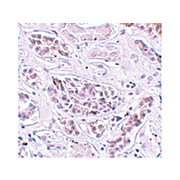 Anti-ATG3 (RABBIT) Antibody, 100µg, Liquid (sterile filtered)