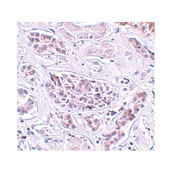 Anti-ATG3 (RABBIT) Antibody, 100µg, Liquid (sterile filtered)