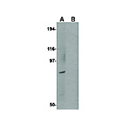 BICD1 Antibody 100µg