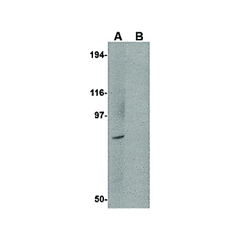 BICD1 Antibody 100µg