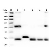 Anti-RAT IgG (H&L) (RABBIT) Antibody Texas Red™ Conjugated (Min X Human Serum Proteins), 1mg, Lyophilized