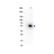 Anti-MOUSE IgG1 (Gamma 1 chain) (RABBIT) Antibody Peroxidase Conjugated, 1mg, Lyophilized