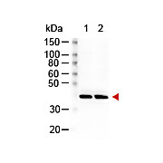 Anti-RABBIT IgG (H&L) (GOAT) Antibody Peroxidase Conjugated, 2mg, Lyophilized