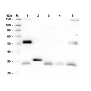 Anti-RAT IgG (H&L) (SHEEP) Antibody Fluorescein Conjugated, 2mg, Lyophilized