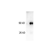 Anti-RABBIT IgG (H&L) (GOAT) Antibody Peroxidase Conjugated (Min X Human Serum Proteins), 100µg, Lyophilized