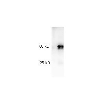 Anti-RABBIT IgG (H&L) (GOAT) Antibody Peroxidase Conjugated (Min X Human Serum Proteins), 100µg, Lyophilized