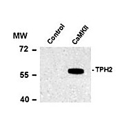 Anti-Tryptophan Hydroxylase 2 pS19 (Rabbit) Antibody, 100µL, Liquid
