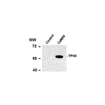 Anti-Tryptophan Hydroxylase 2 pS19 (Rabbit) Antibody, 100µL, Liquid