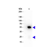 Anti-RABBIT IgG (H&L) (RAT) Antibody Peroxidase Conjugated (Min X Hu, Gt, Ms Serum Proteins), 1mg, Lyophilized