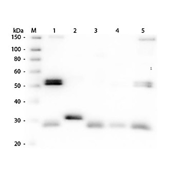 Anti-RAT IgG (H&L) (SHEEP) Antibody Peroxidase Conjugated, 2mg, Lyophilized