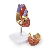 Heart Models