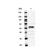 Anti-MOUSE IgG1 (Gamma 1 chain) (RABBIT) Antibody Alkaline Phosphatase Conjugated, 1mg, Liquid (sterile filtered)