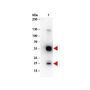 Anti-RAT IgG (H&L) (GOAT) Antibody Peroxidase Conjugated (Min X Bv Ch Gt GP Ham Hs Hu Ms Rb & Sh Serum Proteins), 1mg, Lyophilized
