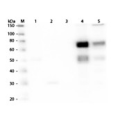 Anti-RAT IgM (mu chain) (GOAT) Antibody Biotin Conjugated, 1mg, Lyophilized