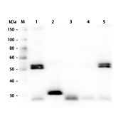 Anti-RAT IgG (H&L) (CHICKEN) Antibody Peroxidase Conjugated, 1mg, Lyophilized