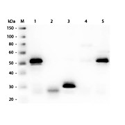 Anti-RABBIT IgG (H&L) (SHEEP) Antibody Peroxidase Conjugated (Min X Bv Ch Gt GP Hs Hu Ms Rt & Sh Serum Proteins), 1mg, Lyophilized