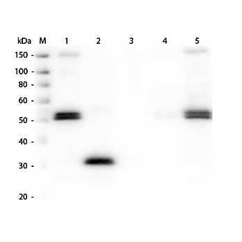 Anti-RAT IgG F(c) (RABBIT) Antibody Peroxidase Conjugated, 1.5mg, Lyophilized