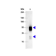 Anti-RABBIT IgG (H&L) (SHEEP) Antibody Alkaline Phosphatase Conjugated, 1mg, Liquid (sterile filtered)