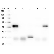 Anti-RABBIT IgG (H&L) (DONKEY) Antibody Rhodamine Conjugated, 2mg, Lyophilized