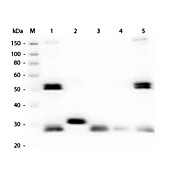Anti-RAT IgG (H&L) (GOAT) Antibody (Min X Bv Ch Gt GP Ham Hs Hu Ms Rb & Sh Serum Proteins), 1mg, Liquid (sterile filtered)