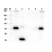 Anti-RAT IgG F(c) (GOAT) Antibody Peroxidase Conjugated, 2mg, Lyophilized