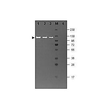 HAMSTER COMPLEMENT (lyophilized) with DILUENT, 5mL, Lyophilized