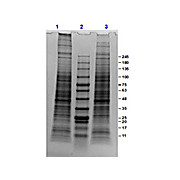 PC-3 Whole Cell Lysate, 500µg, Liquid (sterile filtered)