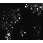 AKT3 Antibody Combo Pack, 1Pack, Liquid and Lyophilized